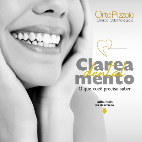 Clareamento Dental